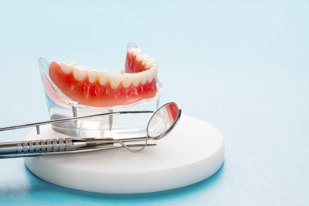 Dental Inlays and Onlays in Liberty, MO
